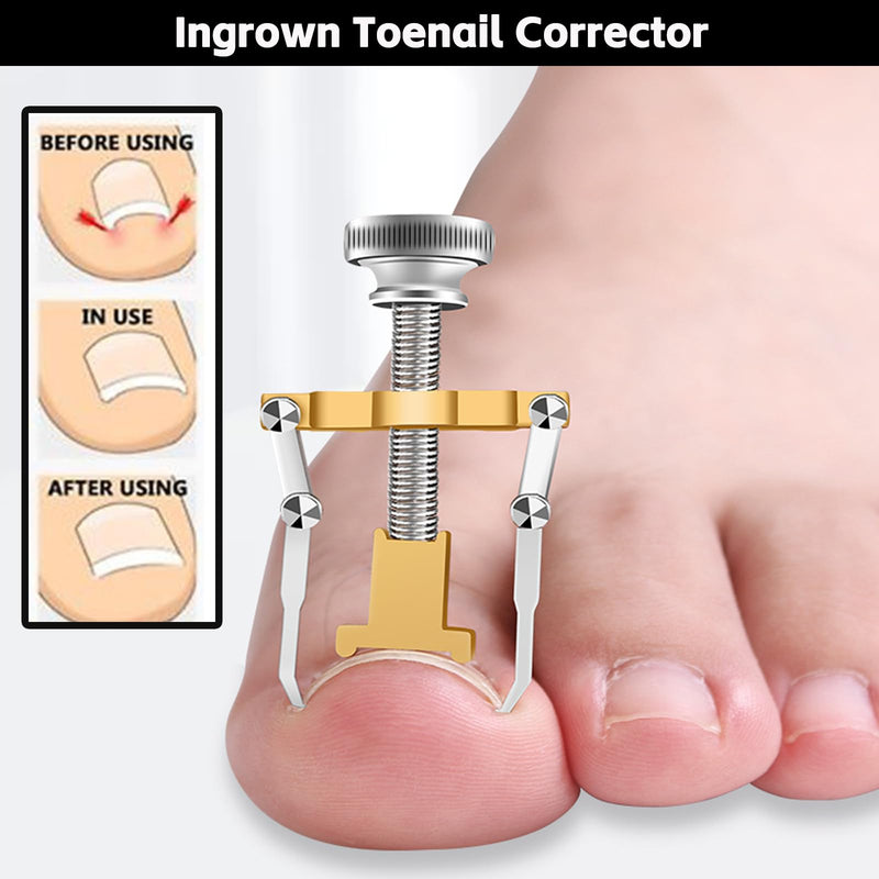 NOVANO Ingrown Toenail Removal Kit,Nail Treatment Foot Tool,Toenail Clippers for Seniors Thick Toenails,Professional Pedicure Tool,Large Toenail Clippers for Thick Nails 11Pcs - BeesActive Australia