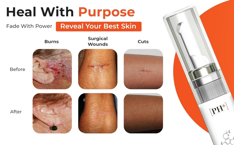 Silicone Scar Gel Cream for Old,New Scars, Keloids, C-Section, Burns, Acne, Surgical Treatment – Cosmetic Formula with Patented Silicone & Sea Berry Oil,Clinically Tested, Made in USA