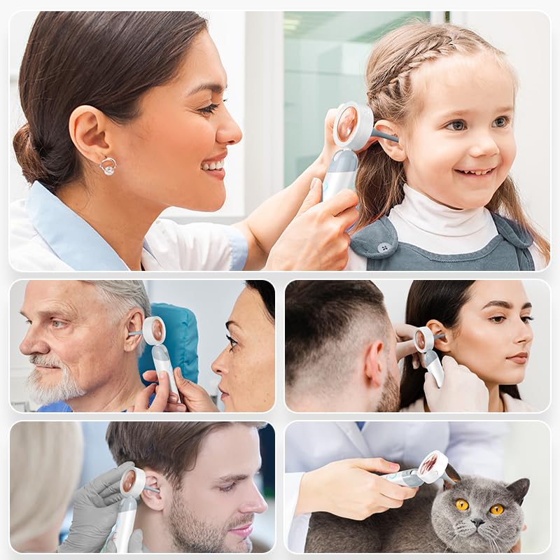 Smart Ear Camera with Screen, 2MP HD Otoscope, 90° Rotating Head, 1.38" Display, 12 Specula Tips, Photo & Video Function - BeesActive Australia