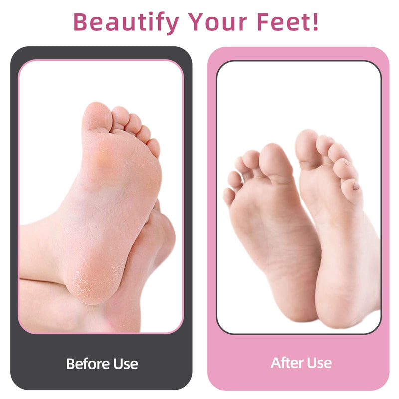 4.8IN Longer Electric Foot Callus Remover with 80pcs Sandpaper Discs, Professional Aluminum Callus Remover for Feet, Stepless Speed Control Pedicure Tools for Dead Skin (Pink) Pink - BeesActive Australia
