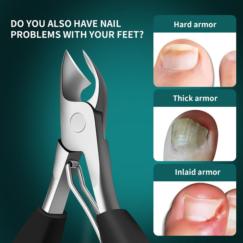 DEOU Heavy Duty Large Opening toenail Clippers, Suitable for Embedded Growth and Rough Nails, Home Pedicure Tools for Men, Women, Elderly Newly Upgraded Stainless Steel (Nail Clippers+Gift Box) Heavy Nail Clippers - BeesActive Australia