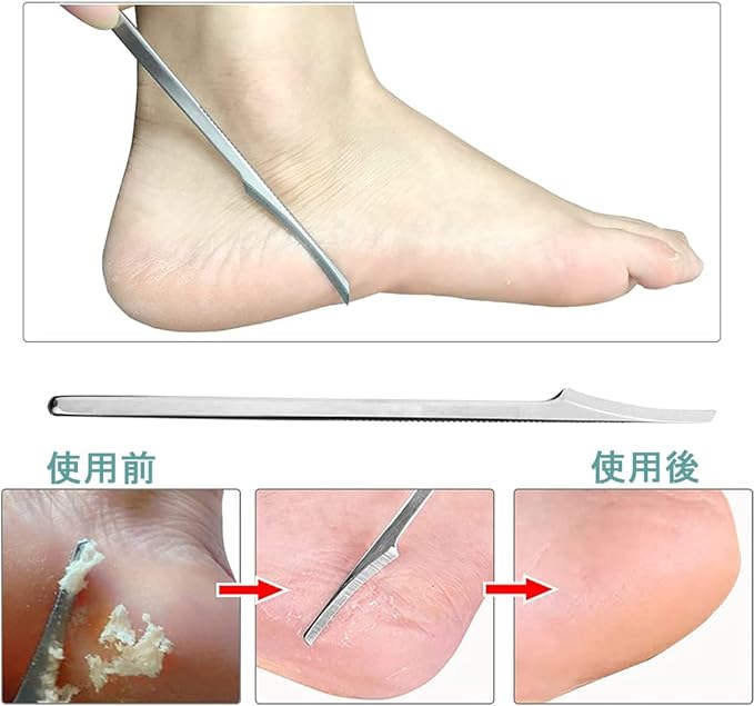 Samcos Exfoliating Fish Eye Removal, Stainless Steel Foot Care Set, Removes Exfoliates, Removes Plantar Stains, Foot Care Tool, Includes 10 Replacement Blades - BeesActive Australia