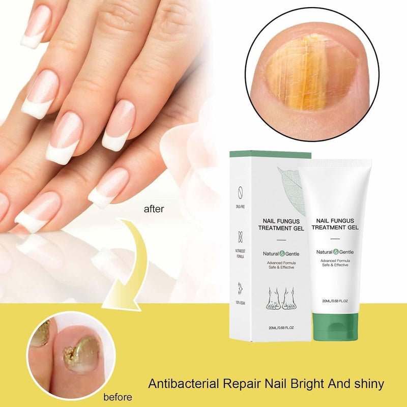 Nail Fungus Treatment Gel - Natural Nail Care Gel, Nail Repair Cream with Colloidal Silver, Emu Oil & Tea Tree Oil for Hydrated, Moisturizing Treatment for Hands & Feet (2pcs) 0.51 Fl Oz (Pack of 2)