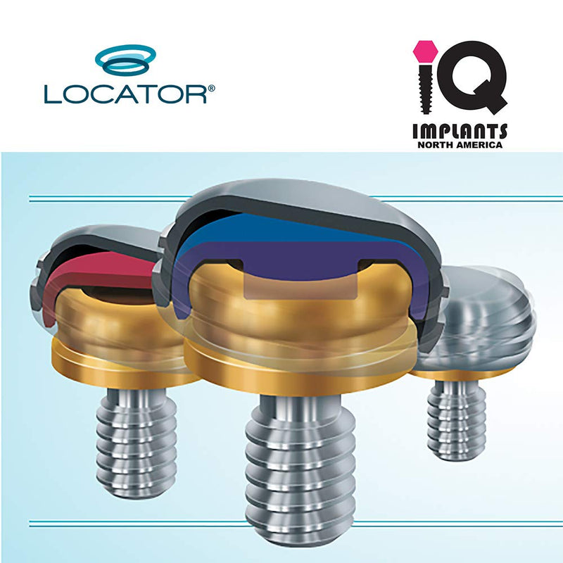 Locator Genuine Original Replacement Male Retention Inserts Caps, Standard, Extra Light, Blue 1.5lbs (4-Pack)
