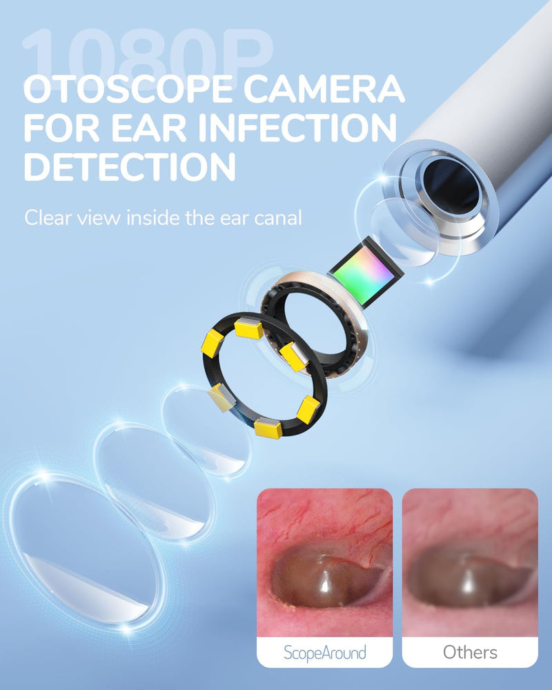 ScopeAround Otoscope with Light, 1080P FHD Ear Scope, 3.9mm Digital Otoscope Camera with 6 LED Lights Ear Wax Removal Tool Camera, Ear Scope with Light, Compatible with USB-C - BeesActive Australia