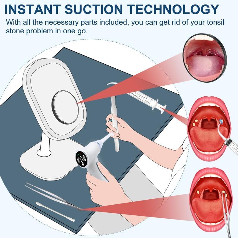 Tonsil Stone Remover Tool, Upgraded Electric Tonsil Stone Removal Kit - with Built-in LED Light & 6-Level Suction for Bad Breath Prevention Blue