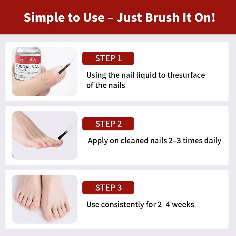 Toenail Fungus Treatment Extra Strength, Nail Fungus Treatment with Undecylenic Acid for Toenail & Fingernails, Antifungal Nail Repair for Athletes Foot, Ingrown, Thick, Broken, Damaged Nail, 30ml 1 Fl Oz (Pack of 1)