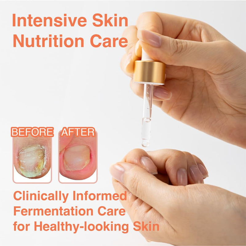 Fermented Nail Oil for Cuticle & Nail Repair | Vegan K-Beauty Serum with Herbal Extracts | Natural Strengthening & Moisturizing Formula for Brittle, Dry Nails | Nourishes, Smooths, Restores | 8ml 0.27 Fl Oz (Pack of 1)
