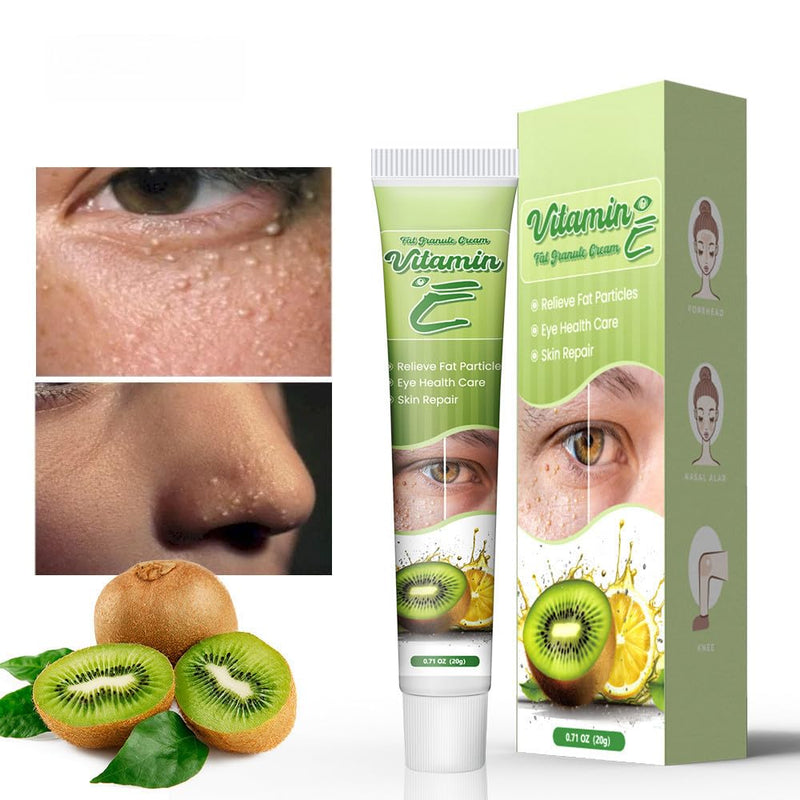 2 - pack Vitamin E Fat Granule Cream with AHA for Skin Care, Fruit - based Moisturizing, Effectively Improve Eye - area Fat Granules and Nourish Skin