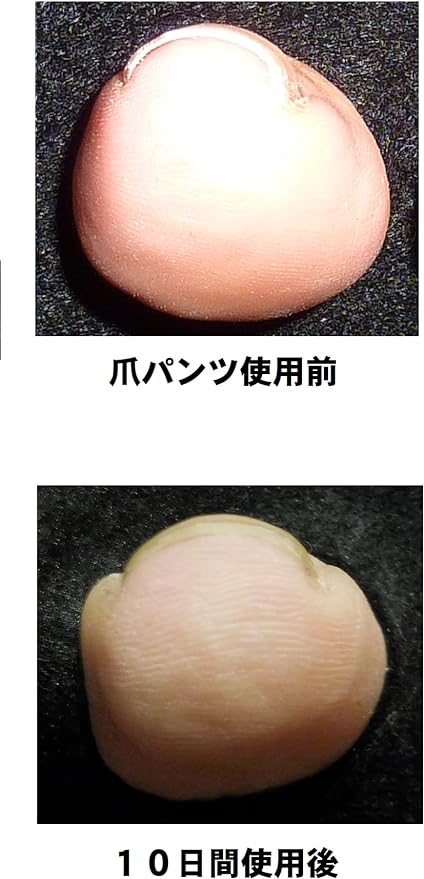 Claw pants (only flat type for easy winding nails) - BeesActive Australia