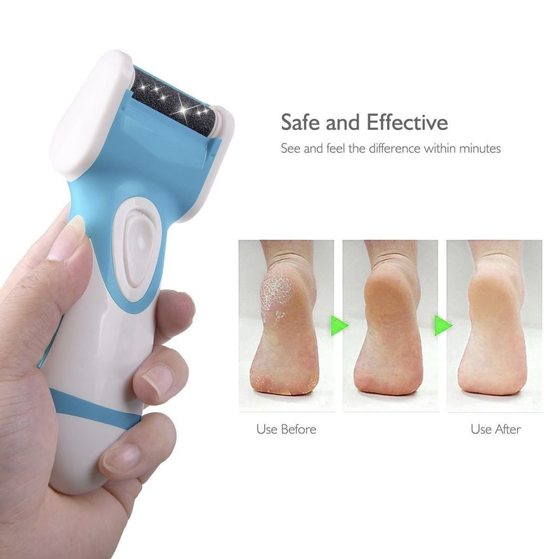 Electric Callus Remover & Foot File (Includes 2 Rollers) Reduce Calluses on Feet in Seconds - BeesActive Australia