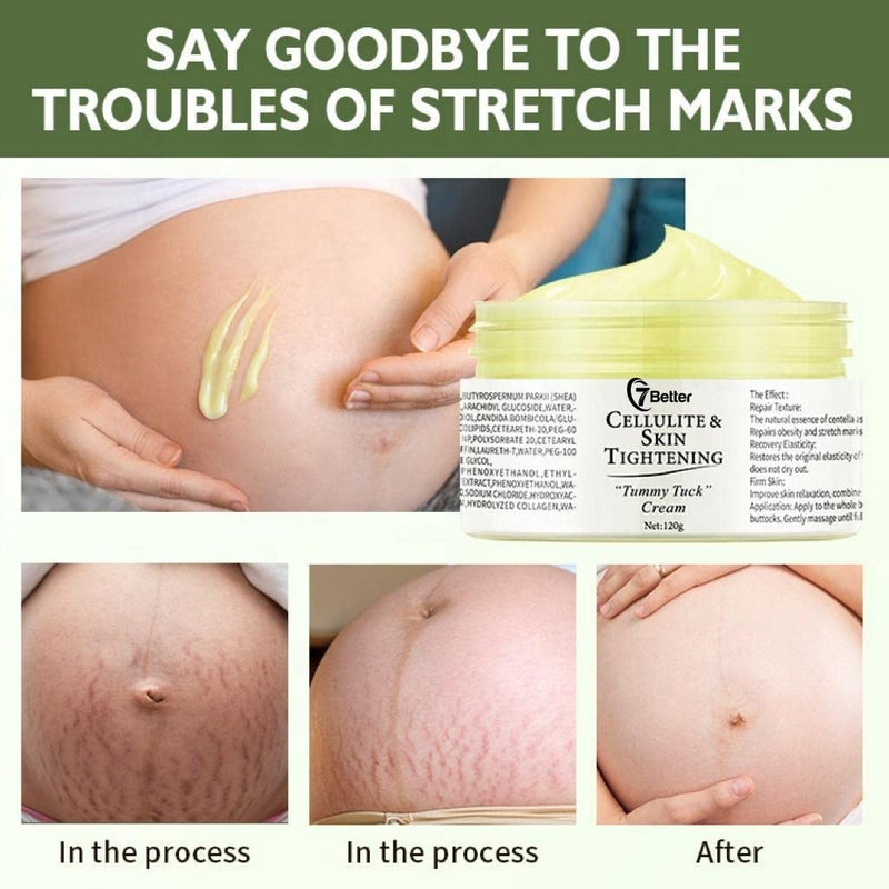 Stretch Marks and Scars Removal Cream for Pregnancy - Scars Repair, Abdominal Firming, and Gentle Stretch Marks Eradication Skincare Body - BeesActive Australia