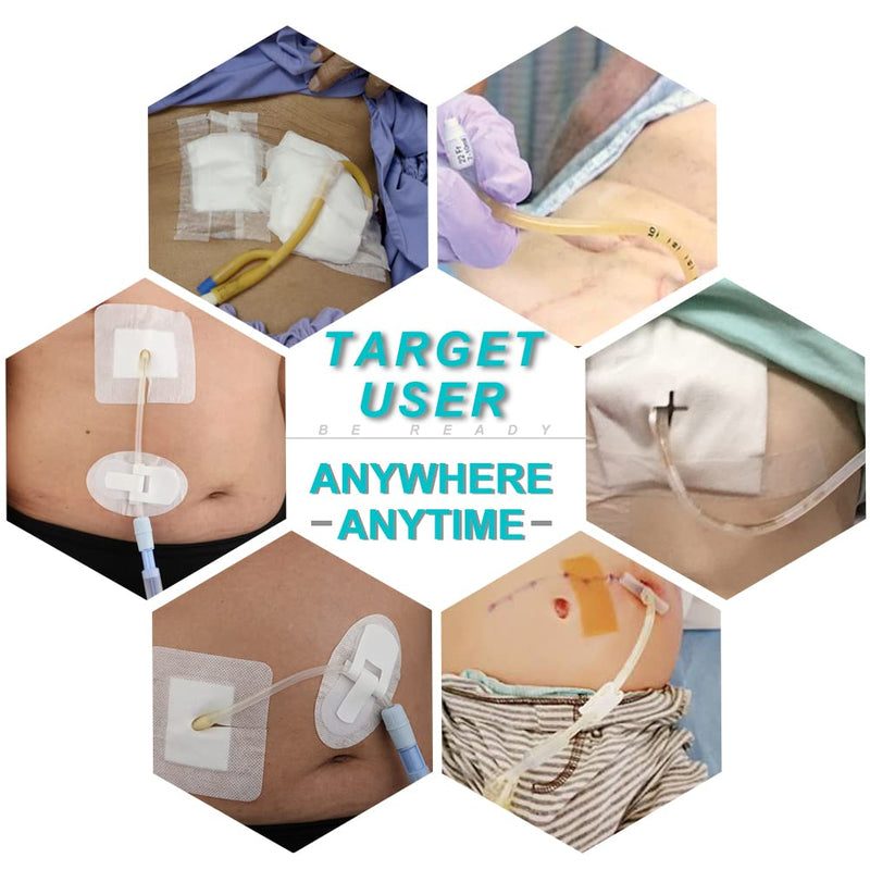Peritoneal Dialysis PD Catheter Drain Split Bordered Gauze Island Dressing Pad for Stomach Feeding Peg J Tube| Individually Packed| Wound Bandage with Adhesive Border 4" x 4" (Pack of 20) 4 x 4 Inch (Pack of 20) - BeesActive Australia