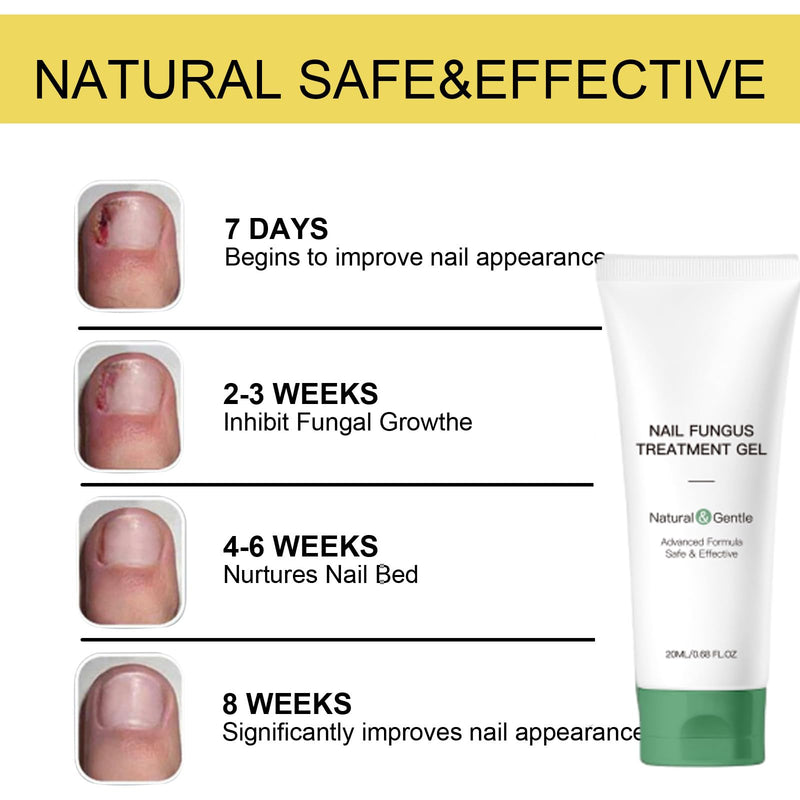 Nail Fungus Treatment Gel, Nail Fungus Treatment Cream,Multi-Purpose Nail Repair Oil Serum (2pcs) 2pcs