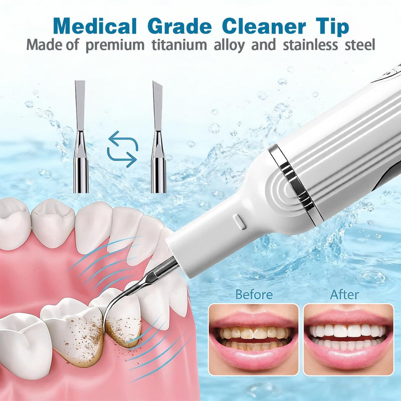 Ultimate Electric Teeth Cleaner - Ultrasonic Tooth Cleaning, Violet Light Protection, 316F Stainless Steel Heads, 5-Speed Modes, IPX6 Waterproof, Oral Care Kit with 7 Accessories‌ (White)