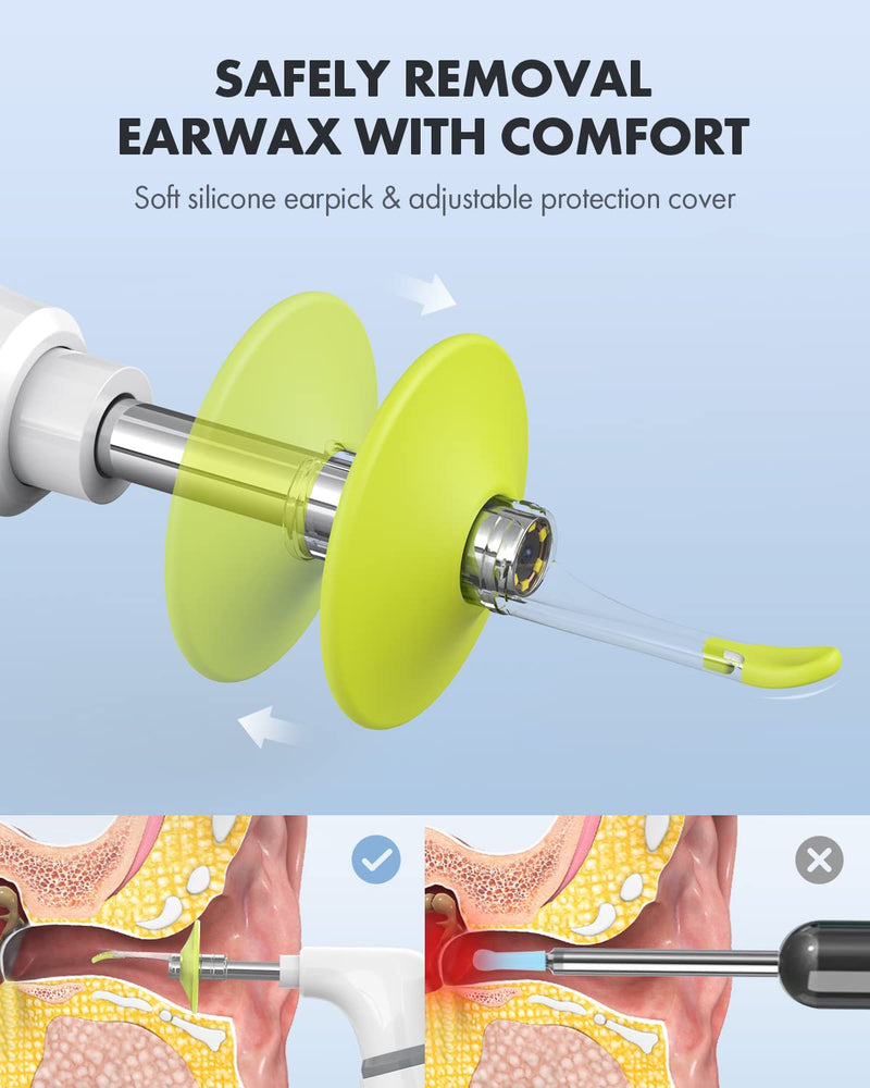 Ear Wax Removal Tool, Replacement Ear Spoon Tips Ear Cleaner, Ear Pick for Anykit Otoscope, Ear Wax Remover Pack of 3. (Green w/ 2 Size) - BeesActive Australia