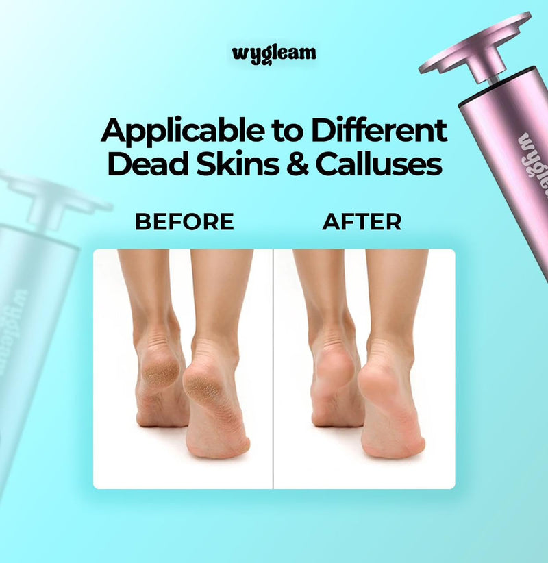 2-in-1 Electric Callus Remover and Nail File Drill Kit for Flawless Feet & Nails - 3 Speeds, Rechargeable, Professional at-Home Pedicure & Manicure Tool Pink
