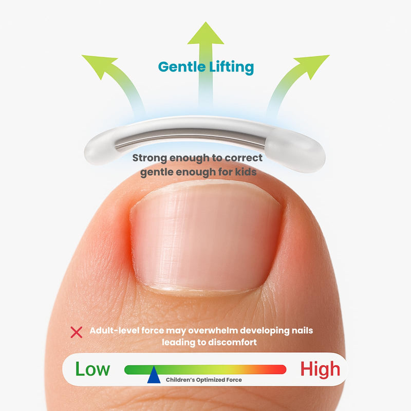 Kids Ingrown Toenail Corrector, Gentle & Safe Ingrown Toenail Treatment for Children, At-Home Solution for Kids Ingrown & Curved Nails, Comfortable Lift for Delicate Nails (0.31 Inch) 0.31 Inch