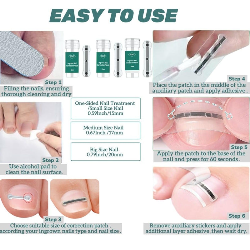 Ingrown Toenail Corrector & Removal Kit - at Home Treatment for Ingrown Toenails, Titanium Alloy Ingrown Toenail Treatment Tools Designed for Curved Nail Repair Suitable for Men Woman (0.59/0.67in)
