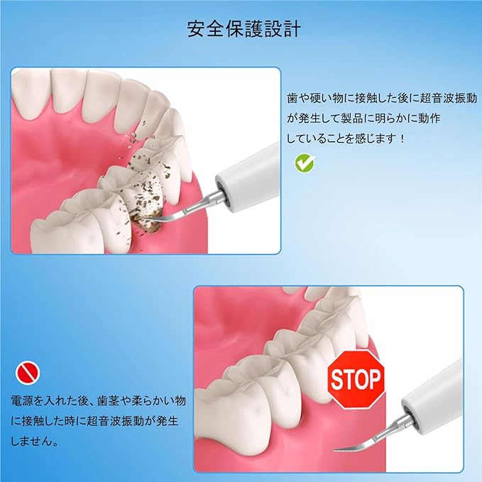 UJHOSLD Ultrasonic Tooth Cleaner, Oral Cleaner, USB Rechargeable, Ultrasonic Vibration, Portable Teeth Cleaner, 5 Modes Adjustable, Built-in LED Lighting, Cleaning Kit, IPX6 Waterproof, Portable and - BeesActive Australia