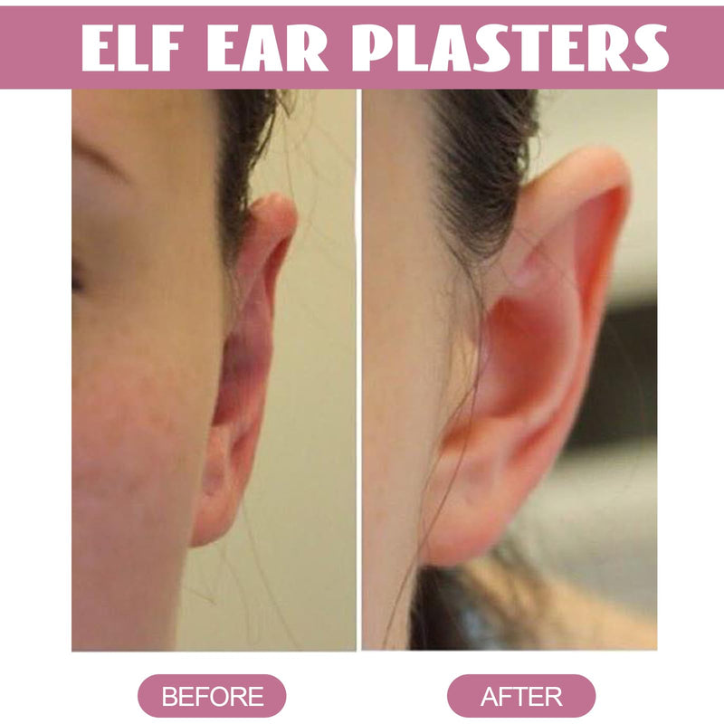 30 Pieces EIf Ear Patches Stickers For Elf Ears, Ear Corrector Cosmetic Hidden Elf Ear Stickers, Ear Patch Corrector For Ear Protrusion