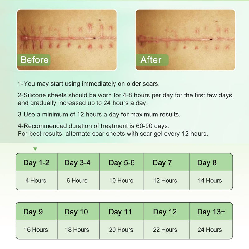 Silicone Scar Sheets(1.8‚Äù x 157‚ÄùInch- 4M), Scar Tape, Scar Strips, Medical Grade, Scar Remover, C-Section, Surgery, Keloid, Tummy Tuck, Scar Patch. - BeesActive Australia