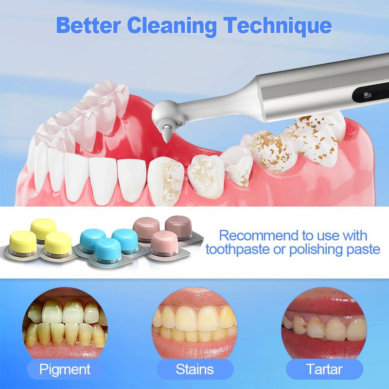Home Tooth Polisher,Multi-Functional LED Tooth Polisher,Aluminum Alloy with Anti-Slip Texture,9 polishing Paste Units,USB Type-C Charging,6 Polished Accessories,Personal Portable Dental Care Tool - BeesActive Australia