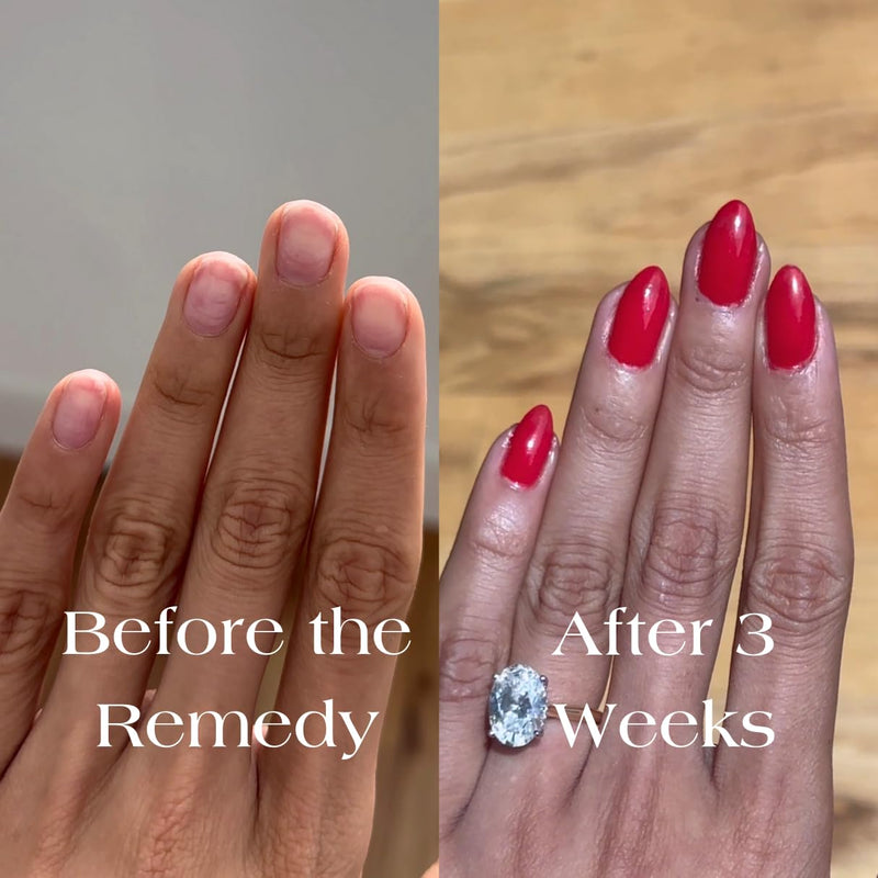 Botanist The Remedy | Nail Strengthening Polish | Repairs & Hardens Nails Damaged from Acrylics, Dip & Gel Manicures | Non-Toxic, 84% Plant Based, 21-Free & Vegan (Poppy Red) Poppy Red