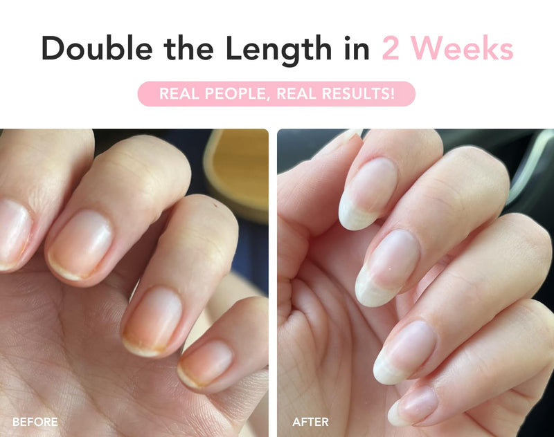 Liaison UltraGrow Nail Serum for Growth and Strength with Keratin Complex, Olive Oil & Vitamin E | Dermatologist-Tested to Support Weak, Brittle, Splitting Nails - BeesActive Australia