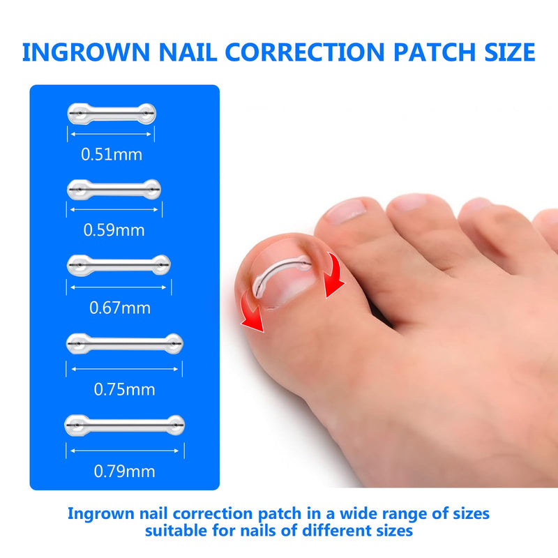 Ingrown Toenail Treatment, Toenail Correction Strips for Curved or Ingrown Nails, Quick Relief, Nail Correction, 5 Different Sizes 1 Count (Pack of 1)