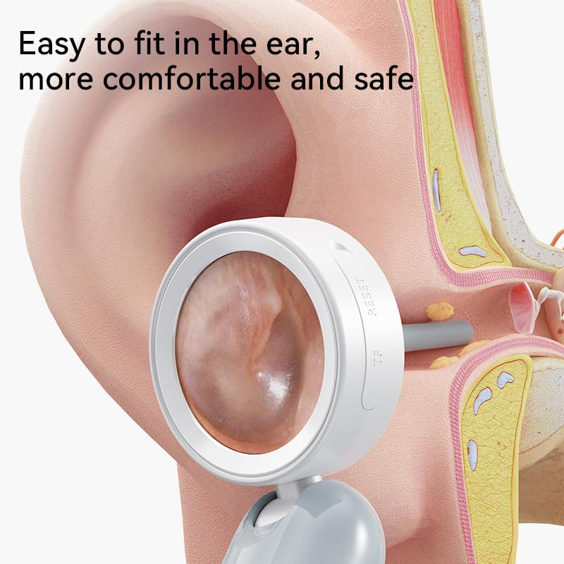 Smart Ear Camera with Screen, 2MP HD Otoscope, 90° Rotating Head, 1.38" Display, 12 Specula Tips, Photo & Video Function - BeesActive Australia