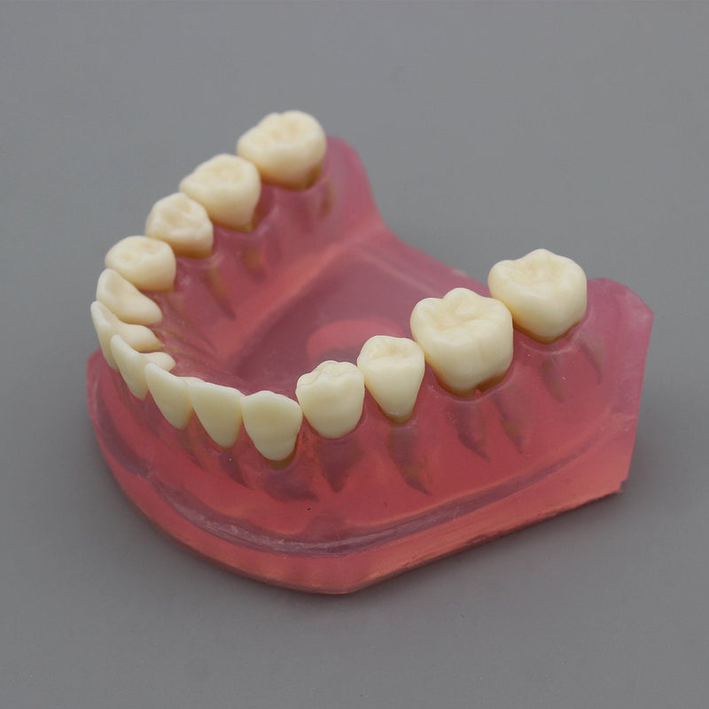 Dental Implant Teeth Model with Removable Teeth for Dental Professionals and Students - BeesActive Australia