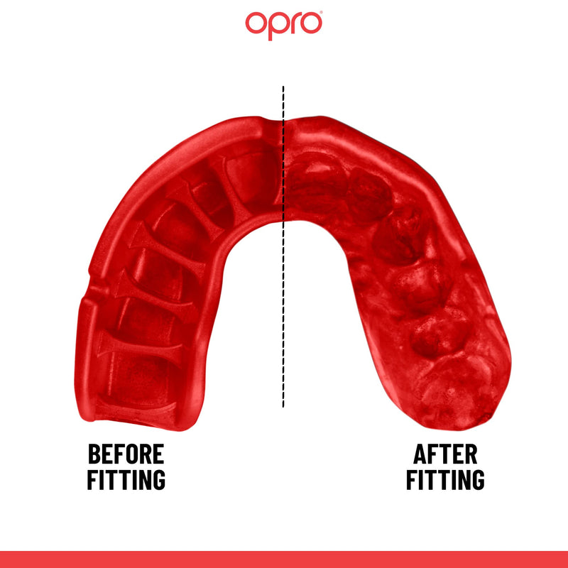 OPRO Platinum Level Mouth Guard, Pro-Level Comfort, Protection & Fit - Moldable Mouth Piece for Boxing, Hockey, MMA, Lacrosse, UFC, jiu Jitsu - Includes Mouthguard Case (Black/White/Red, Adult) Black/White/Red
