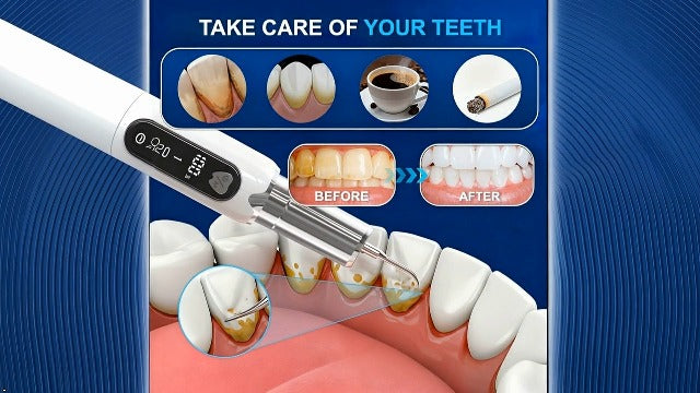 Plaque Remover for Teeth–5 Modes, LED, USB-C 4Tips Adult Teeth Cleaning Kit