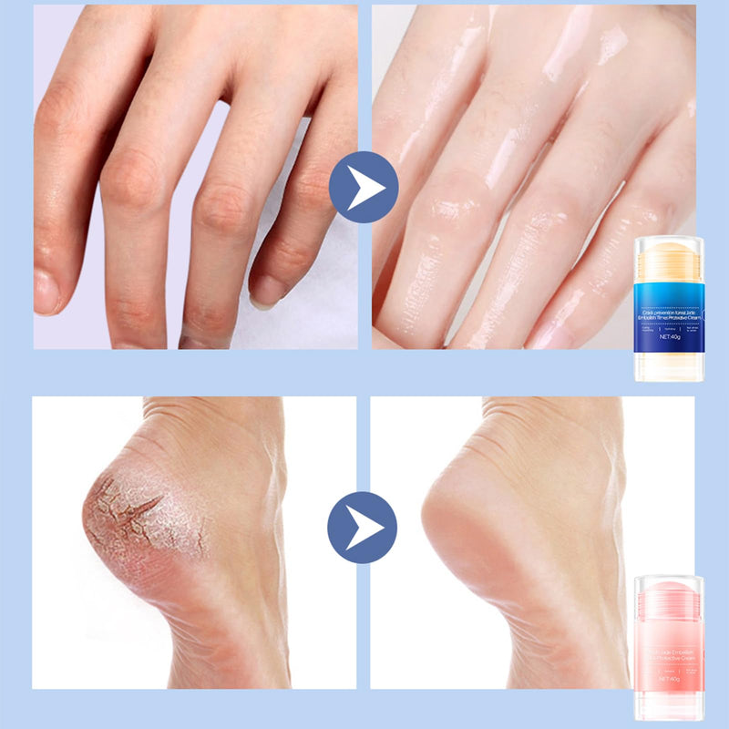 Feet Cracking Prevention Stick,Anti-Cracking Foot & Hand Cream Moisturizer for Dry Cracked Heel Feet, Knee, Elbow, Foot Balm Stick for Callus Remover & Dead Skin Softener (Pink+Blue)