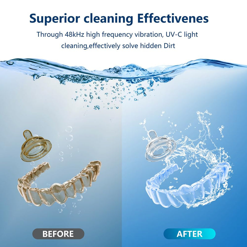 500ML Capacity 48kHz, Updated Version Ultrasonic Retainer Cleaner, Multi-Functional Cleaner Machine For Dentures, Mouth Guards, Braces, Toothbrush, Jewelry, Glasses with Alam Clock Function, (white)