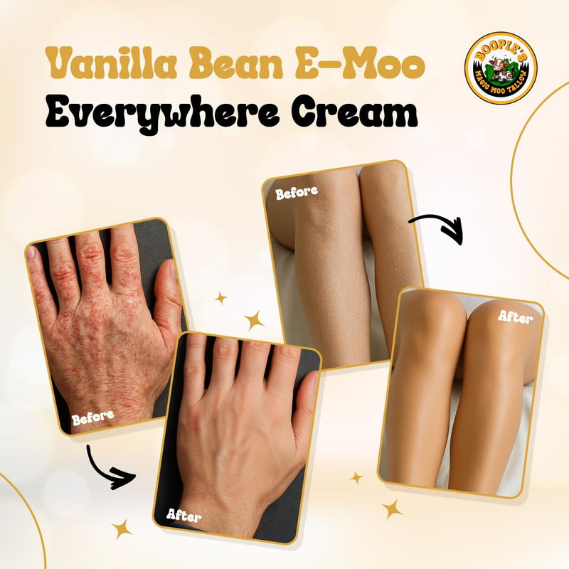 Magic Moo Beef Tallow Vanilla Bean E-Moo Moisturizing Everywhere Suet Tallow Cream with Organic Emu Oil. For Acne, Stretch Marks, Eczema, Hydration, Dry Skin & More! 2oz 2 Ounce (Pack of 1) - BeesActive Australia
