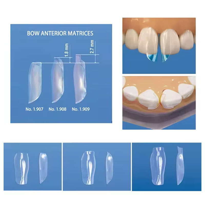 Dental Clear Matrix Anterior Matrice, BT Anterior Matrices Bioclear Style, Transparent Bow Anterior Matrices Sectional Contoured Matrix System (1, S) 1