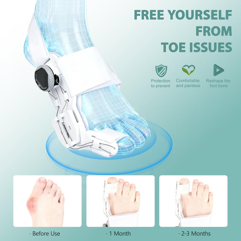 GAB Upgraded Bunion Corrector for Women & Men - Adjustable Bunion Splint with Knob for Big Toe Relief & Hallux Valgus Correction, Day/Night Orthopedic Toe Straightener (2, White) 2