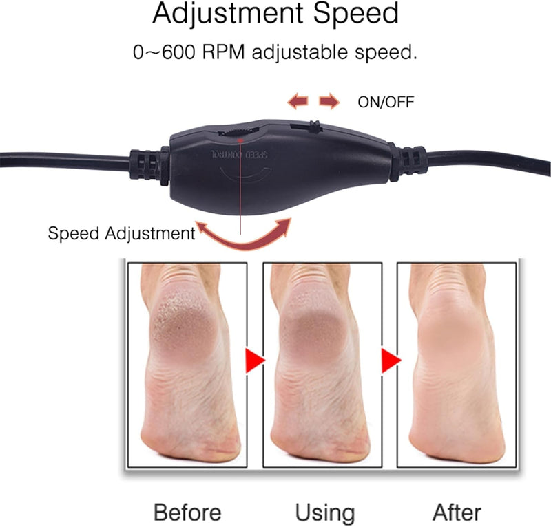 Electronic Foot File Grinder (Speed Adjustable) with 60pcs Replacement Sandpaper Disk，Electric Foot Scrubber Dead Skin Remover，for Feet Hard Cracked Dry Dead Skin Exfoliation，Unisex（Black） Black - BeesActive Australia