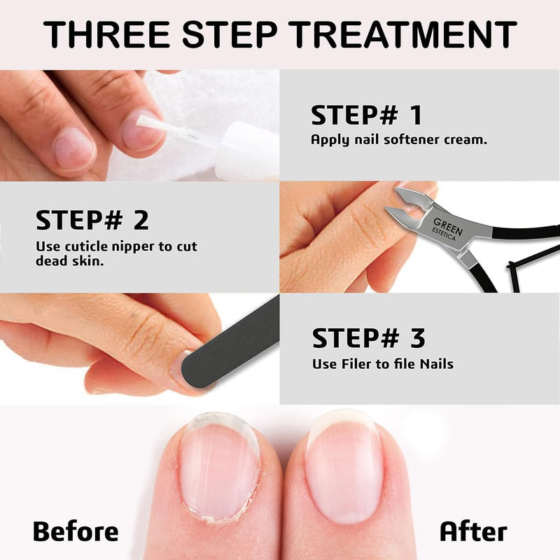Professional Cuticle Trimmer Nail Cuticle Cutter Stainless Steel Cuticle Nippers with Sharp Blades of Cuticle Remover Clippers Manicure Tools Double Spring - Pedicure Nail Tools (Black - 4 Pack) Black Nipper - Pack of 4 - BeesActive Australia