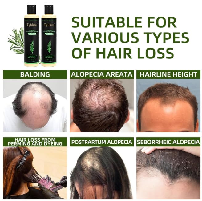Tgideas Rosemary Biotin Volumizing Shampoo for Thinning Hair, 2Pack Rosemary - Shampoo*2(14.8 Fl Oz)