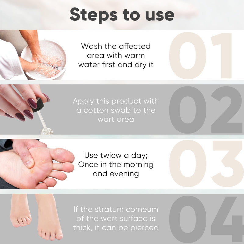 Wart & Corn Remover Liquid, Smoothes Skin Gentle Fast Acting Gel Wart Removal for Plantar Wart Flat Warts and Corns White - BeesActive Australia