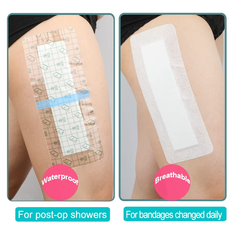 Waterproof Incision Bandages for Large Wounds Knee Hip Replacement Adheisve Island Dressing Bandaid Tape Post Surgical Shower Protector, No Glue On Center 4 x 10 Inch (Pack of 14) Waterproof 4"x10" Pack of 14