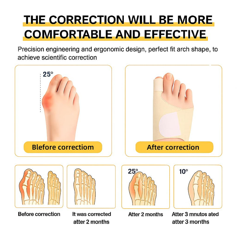 Bunion Corrector Support Brace: Pain Relief & Foot Alignment for Women & Men, 1 Pair for Day & Night Use Spandex 2 Built-in Springs