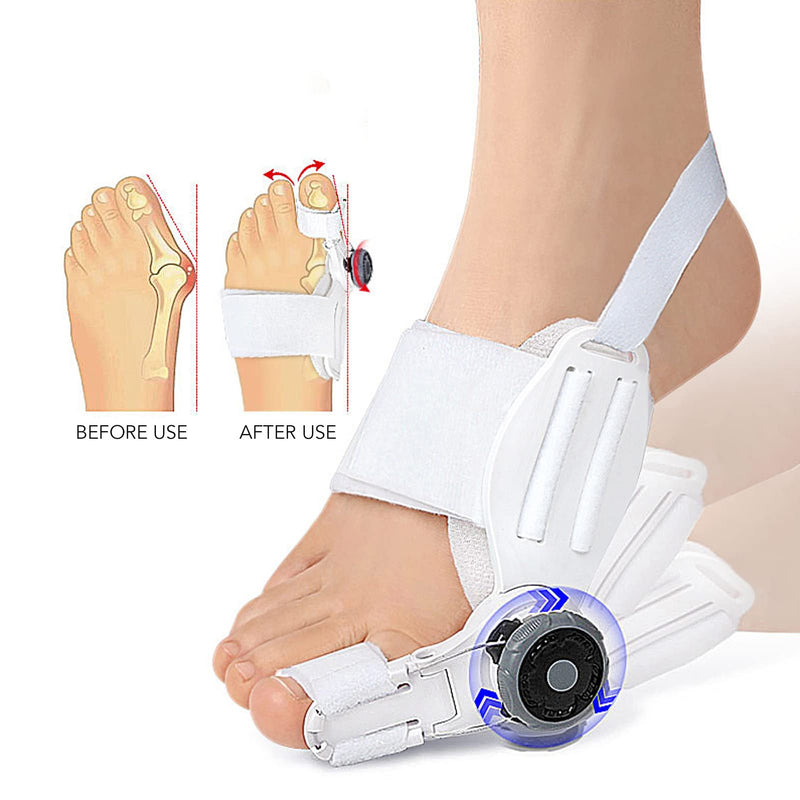 Hallux Valgus Bunion Corrector for Women and Men,Orthopedic Bunion Toe Straightener,Adjustable Bunion Splint for Bunion Relief Black Buckle(1PC)