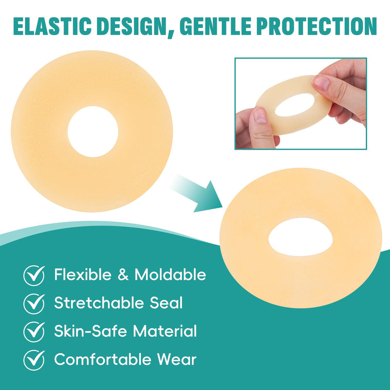 40Pcs Ostomy Barrier Ring - Outer Diameter 2" (50mm) 2mm Thickness,Moldable Ostomy Rings,Hydrocolloid Skin Extender Rings for Colostomy Bags 40 PCS - BeesActive Australia