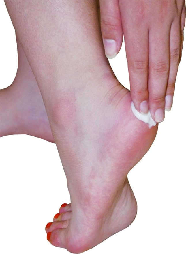 Top Run Heel Cream 3.9 oz (110 g) - BeesActive Australia