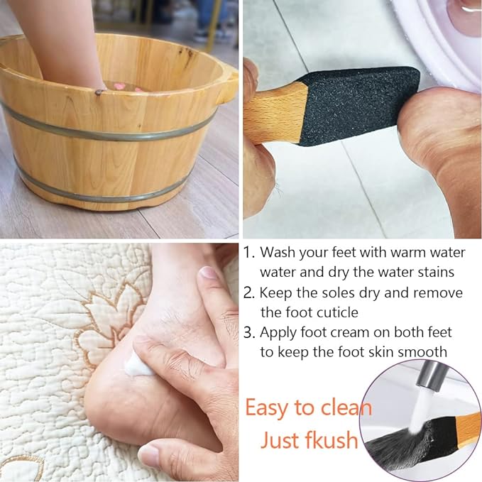 Foot Scrubber Pedicure File Tool Exfoliating for Corn and Hard Skin Calluses Pumice Stone for Feet Heels Elbows Hands - BeesActive Australia