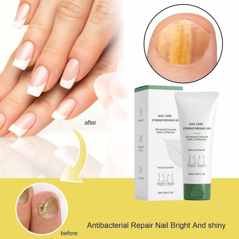 Nail Fungus Treatment Gel, Natural Nail Repair Care Gel, Nail Oil for Growth & Strength, Nail Growth Serum, Strengthening Cuticle Serum - 2pcs 0.1 Fl Oz (Pack of 2)